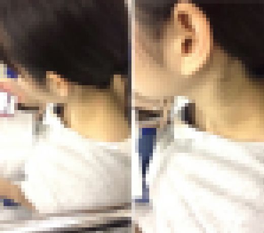 パイン09　サンプル画像1