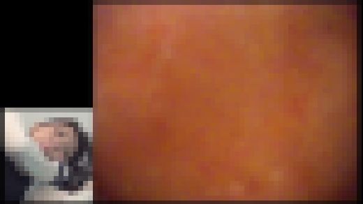 【FetishJapan】肛門科腸内映像 アナル診察 #008 SFJ5-087-08 サンプル画像2