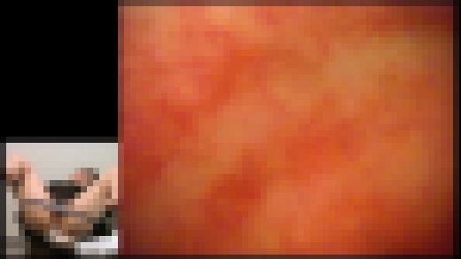 【FetishJapan】肛門科腸内映像 アナル診察 #008 SFJ5-087-08 サンプル画像3
