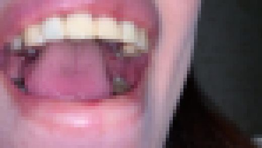 歯姫 5人目 [FBOM-00014]　サンプル画像3