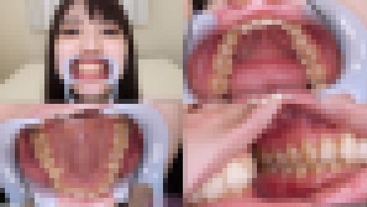 【歯フェチ】藤波さとりちゃんの歯を観察しました！　サンプル画像1