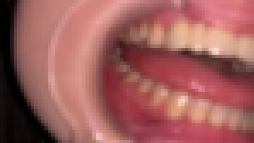 歯姫 18人目 [FBOM-00057]　サンプル画像3