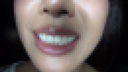 口腔①　サンプル画像1