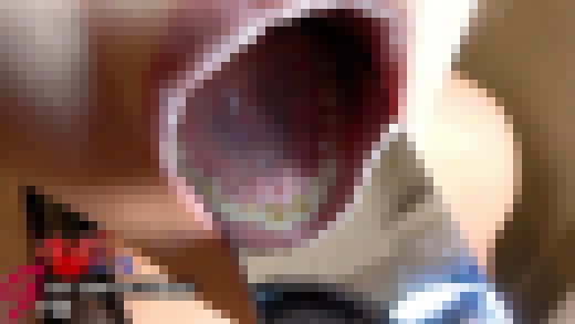 長身&長舌ギャル麻里香の虫歯知らずな口腔内を開口器で羞恥徹底鑑賞 サンプル画像3