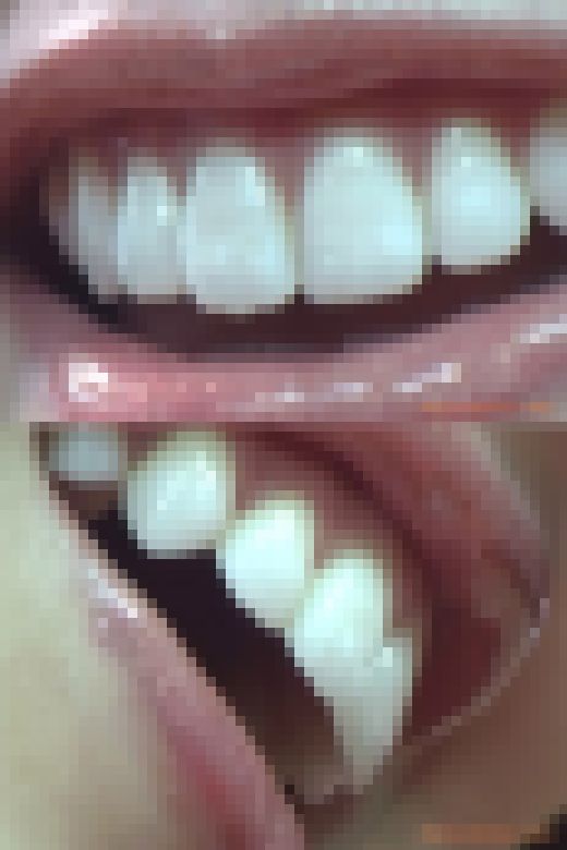 【お得なSET販売】綺麗なお姉さまのお口事情[20060100]　サンプル画像2