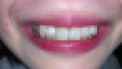 歯姫 37人目 [FBOM-00091]　サンプル画像2