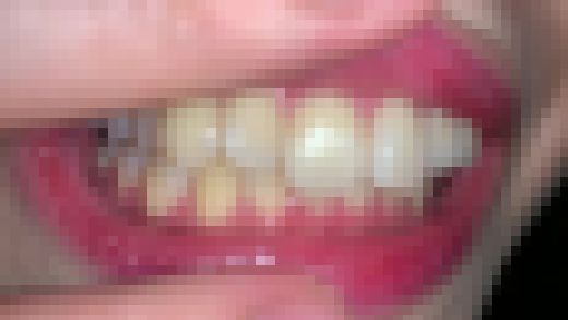 歯姫 37人目 [FBOM-00091]　サンプル画像3