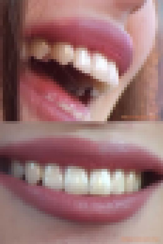 【HD】綺麗なお姉さまのお口事情[20020404]　サンプル画像3