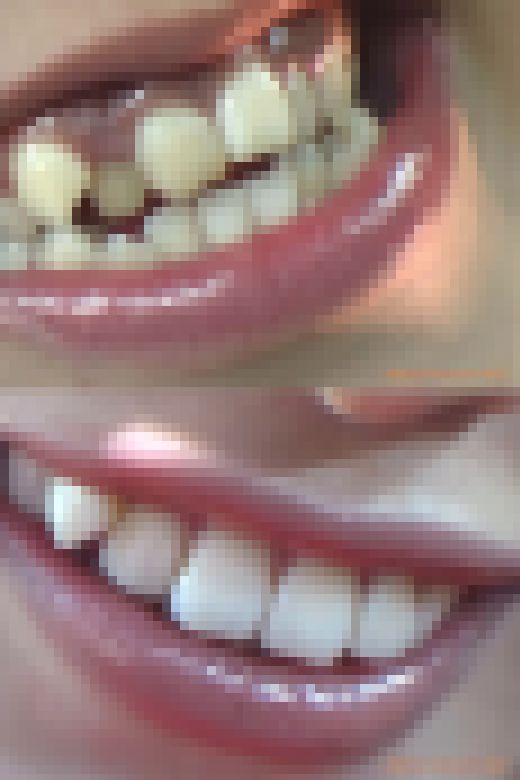 【HD】綺麗なお姉さまのお口事情[20020406]　サンプル画像1