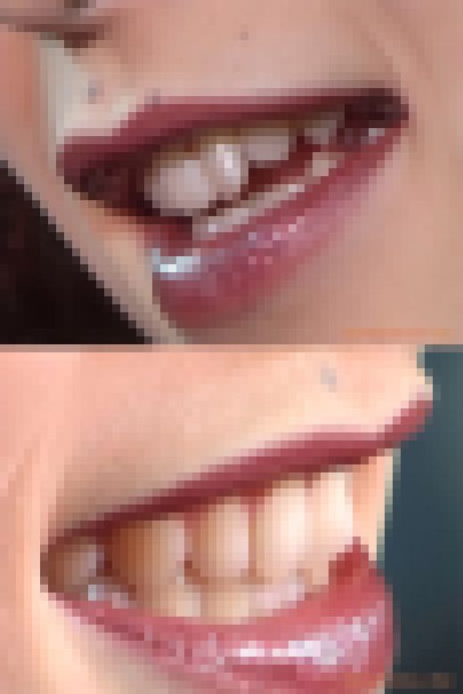 【HD】綺麗なお姉さまのお口事情[20020406]　サンプル画像3