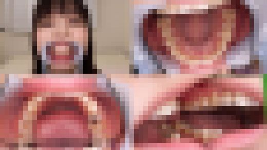 【歯フェチ】江本あやみちゃんの歯を観察しました! サンプル画像1