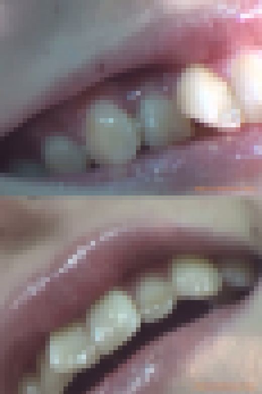 【HD】綺麗なお姉さまのお口事情[20050104]　サンプル画像3