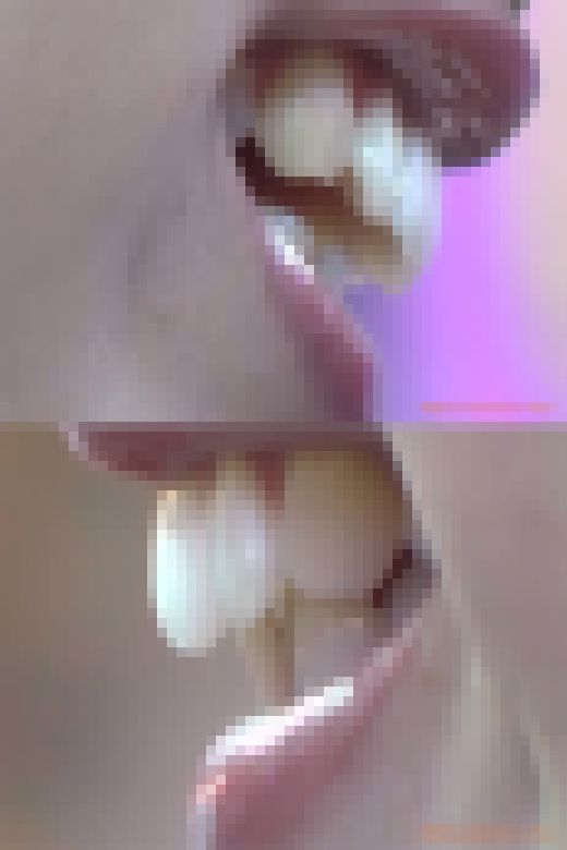 【HD】綺麗なお姉さまのお口事情[20030306]　サンプル画像1