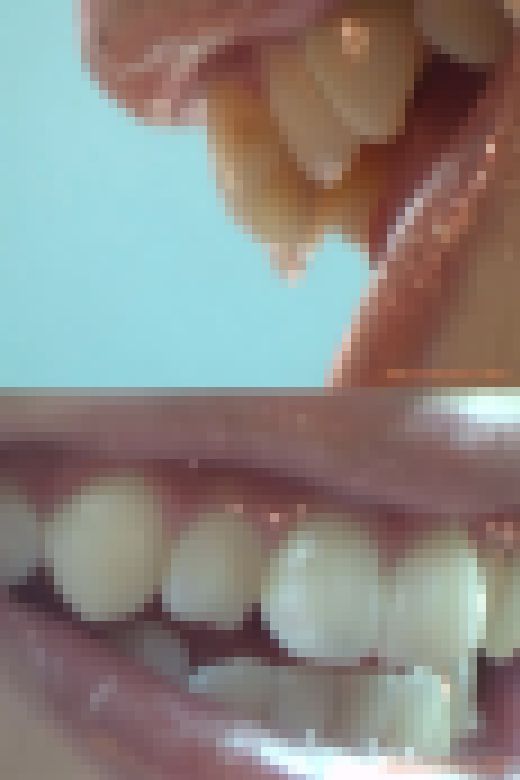 【HD】綺麗なお姉さまのお口事情[20030306]　サンプル画像3