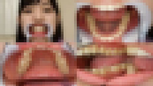 【歯フェチ】宇流木さらちゃんの歯を観察しました！　サンプル画像1