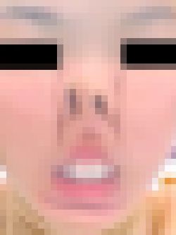 プレミア★ノーズＸＸ　理想の美鼻美顔　サンプル画像1