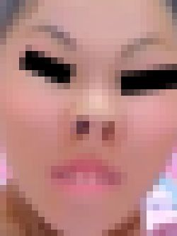 プレミア★ノーズＸＸ　理想の美鼻美顔　サンプル画像2