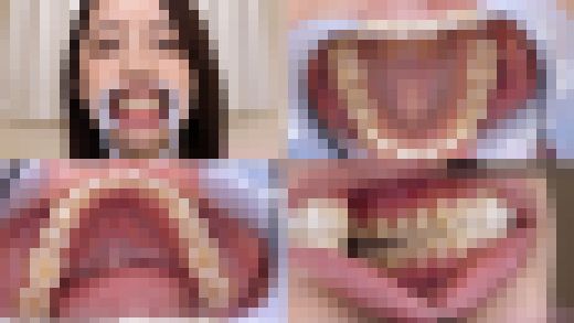 【歯フェチ】6年ぶり2回目!矯正完了した美咲かんなさんの歯を観察しました! サンプル画像1