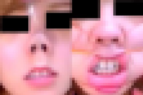 プレミア★ノーズXX カワ系異種格闘顔(上) サンプル画像3