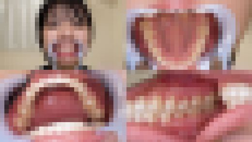 【歯フェチ】もなみ鈴ちゃんの歯を観察しました！　サンプル画像1
