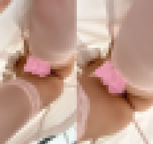 【パンチラ逆さ撮り】エグい食い込みの薄ピンクTバック♡施術中に真下から亀を潜り込ませたら絶景が見れました【ナース サンプル画像2