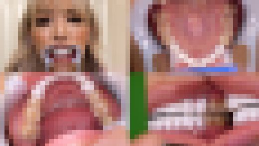 【歯フェチ】霜月るなちゃんの歯を観察しました! サンプル画像1