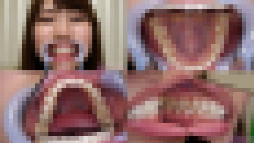 【歯フェチ】竹内夏希ちゃんの歯を観察しました！　サンプル画像1