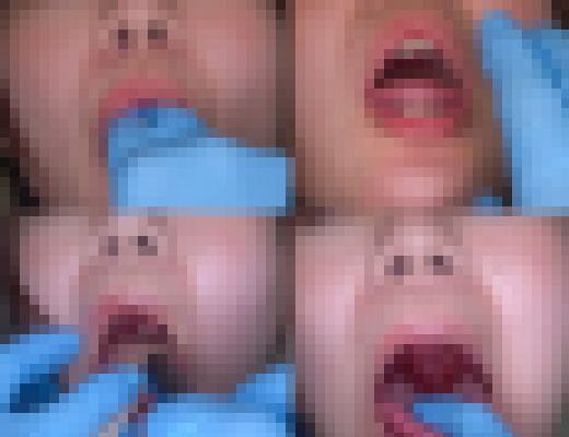 【触診、口腔の羞恥検査⑥】おっとり系ママさんをじっくり検査。口マ●コから溢れ出る愛液。 サンプル画像3