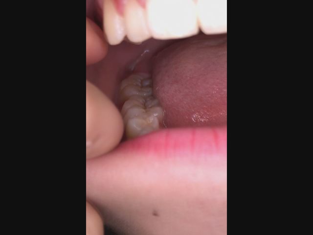 口内・綺麗なお口の中からでる唾液をM男がごくりと飲み干す!!　サンプル画像04