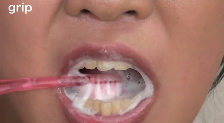 口腔咀嚼診察 粘膜剥き出し!!開口器美女 高沢沙耶　サンプル画像05